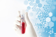 Medical concept image Blood test GettyImages-1208340299
