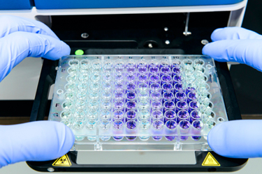 GettyImages-1368887558-assay-bioassay-well