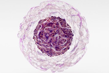 Blog-Cellular-Therapy-in-Neurological-Diseases-1