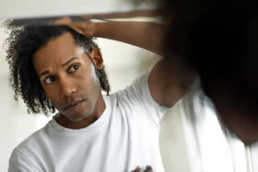 Man worried about hair loss-GettyImages-1336278720