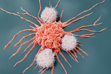 Natural Killer Cells Attacking Cancer Cell GettyImages-1339282270