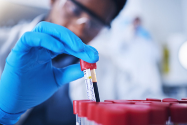GettyImages-1569225312 blood sample, lab, testing