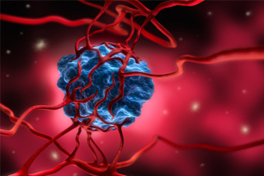 cancer cell-tumor-GettyImages-1168181061