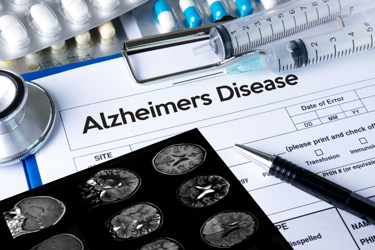 Alzheimers