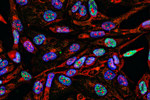 GettyImages-1184711342-imaging-cancer-cells