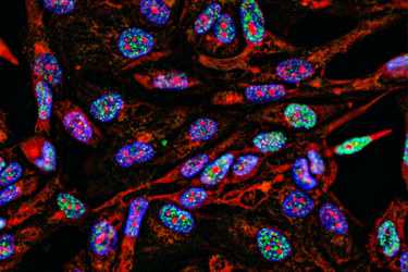 GettyImages-1184711342-imaging-cancer-cells GettyImages-1184711342-imaging-cancer-cells