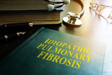 What Would Convince You To Delay Your Trial For 12 Months? What Would Convince You To Delay Your Trial For 12 Months?