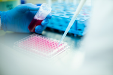 GettyImages-1491009758 lab, cell culture