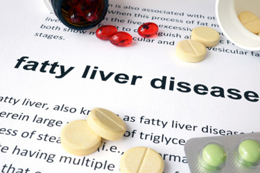 Paper with fatty liver disease and pills-iStock-473954004