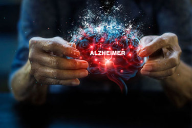 GettyImages-2180907340-woman-holding-brain-alzheimer-disease GettyImages-2180907340-woman-holding-brain-alzheimer-disease