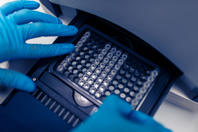 GettyImages-1394835711 PCR