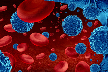 Cancer-in-blood-GettyImages-1303505360