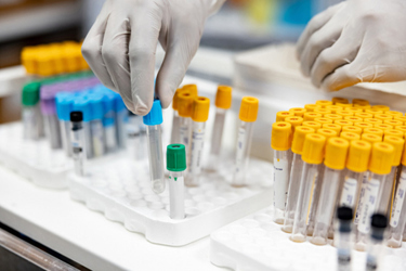 Blood samples in laboratory-GettyImages-1773074083 Blood samples in laboratory-GettyImages-1773074083