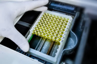 GettyImages-1425761734-assay-researcher-hand-gloves-analysis