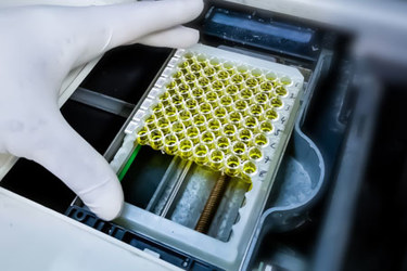 GettyImages-1425761734-assay-researcher-hand-gloves-analysis